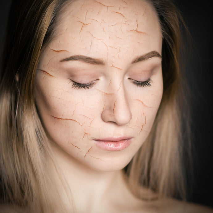 5 characteristics of dehydrated skin and how to fix it