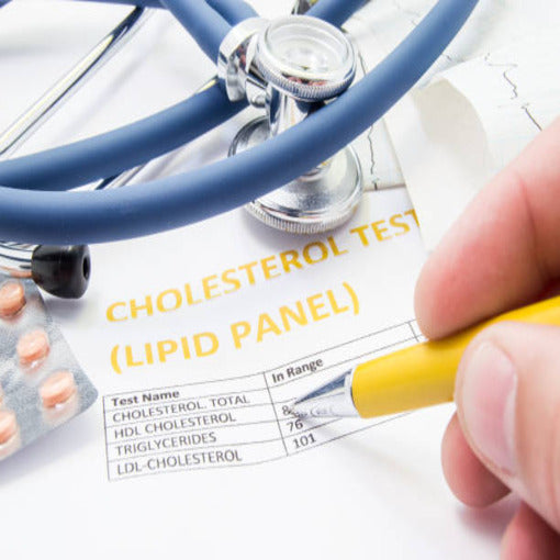 High Cholesterol? Don't Let It Weigh You Down: How Atorvastatin Can Help Lighten The Load