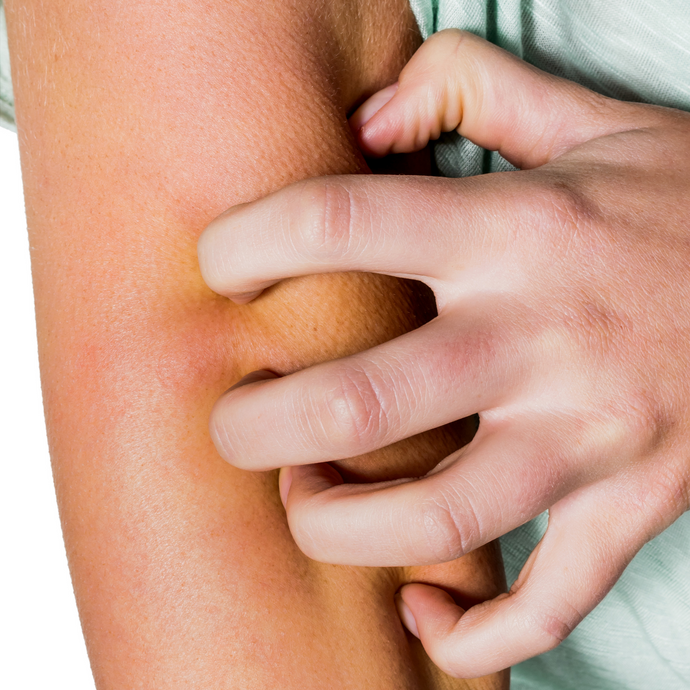 Itchy skin due to central heating: How to solve it?